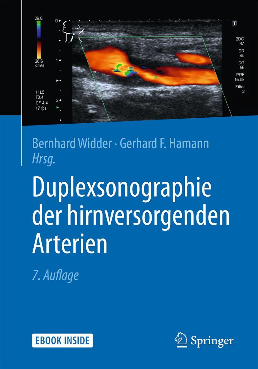 Duplexsonographie der hirnversorgenden Arterien