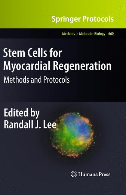 Stem Cells for Myocardial Regeneration