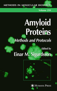 Amyloid Proteins