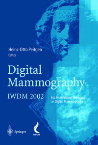 Digital Mammography