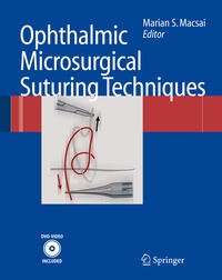 Ophthalmic Microsurgical Suturing Techniques