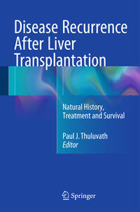 Disease Recurrence After Liver Transplantation