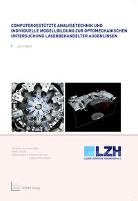 Computergestützte Analysetechnik und individuelle Modellbildung zur optomechanischen Untersuchung laserbehandelter Augenlinsen