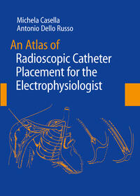 An Atlas of Radioscopic Catheter Placement for the Electrophysiologist