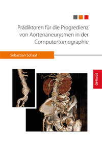 Prädiktoren für die Progredienz von Aortenaneurysmen in der Computertomographie