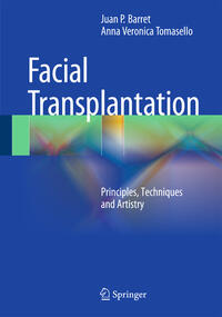 Face Transplantation