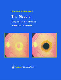 The Macula