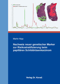 Nachweis neuer genetischer Marker zur Risikostratifizierung beim papillären Schilddrüsenkarzinom