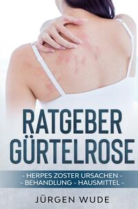 Ratgeber Gürtelrose